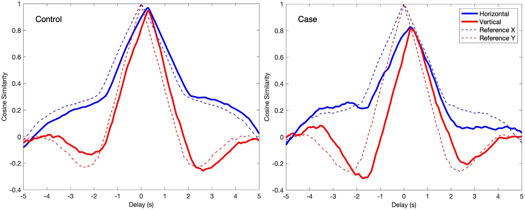 Lagged cosine similarity between stimulus and gaze for a control and an acquired brain injury case, horizontal and vertical, with reference curves