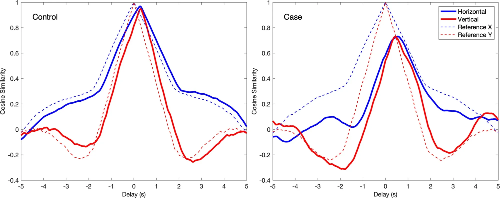 Lagged cosine similarity between stimulus and gaze for a control and a glaucoma case, horizontal and vertical, with reference curves